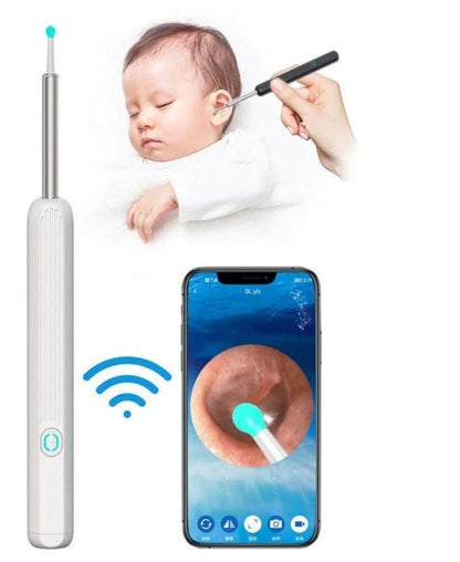 Smart Visual Earwax Removal Kit | جهاز إزالة شمع الأذن الذكي المزود بكاميرا