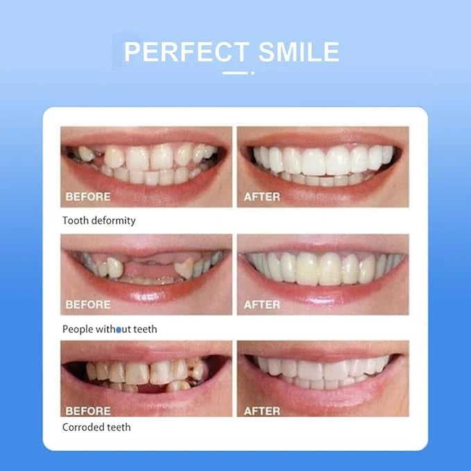 Instant Smile Cosmetic Teeth أسنان تجميلية لابتسامة فورية