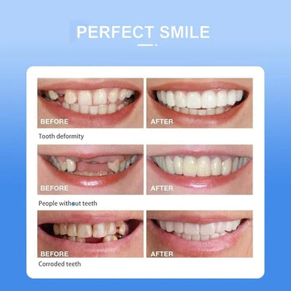 Instant Smile Cosmetic Teeth أسنان تجميلية لابتسامة فورية