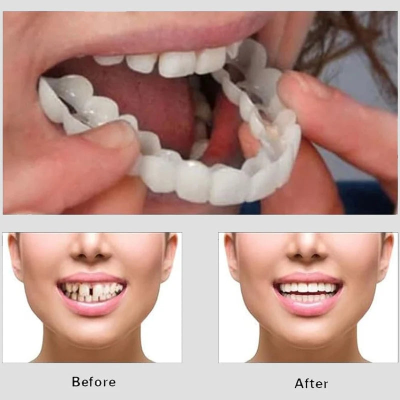 Instant Smile Cosmetic Teeth أسنان تجميلية لابتسامة فورية