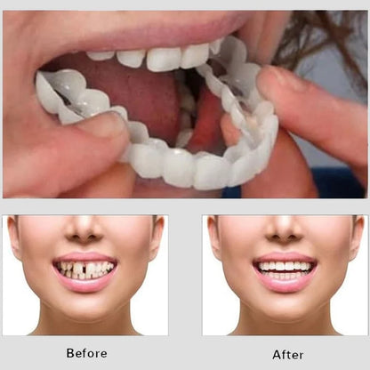 Instant Smile Cosmetic Teeth أسنان تجميلية لابتسامة فورية